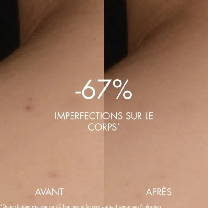 BiothermBiocorps Sérum Anti-Imperfections