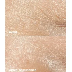 CLINIQUESmart Clinical Repair                Crème Correctrice Anti-rides