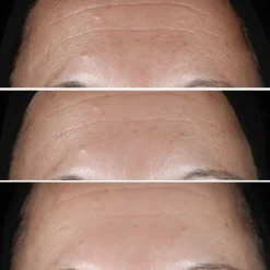 CLINIQUESmart Clinical Repair                Sérum Correcteur Anti-Rides