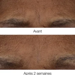 CLINIQUESmart Clinical Repair™                Baume Rétinoïde Anti-Rides