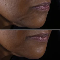 CLINIQUESmart Clinical Repair™                 Crème Liftante Visage + Cou