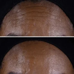 CLINIQUESmart Clinical Repair™                 Crème Liftante Visage + Cou