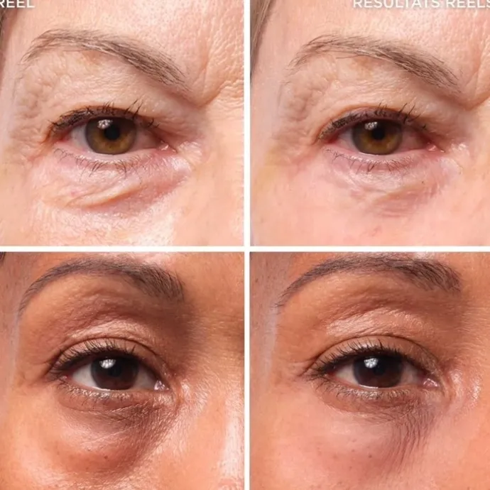 It CosmeticsBye Bye Under Eye Bags Traitement pour les poches