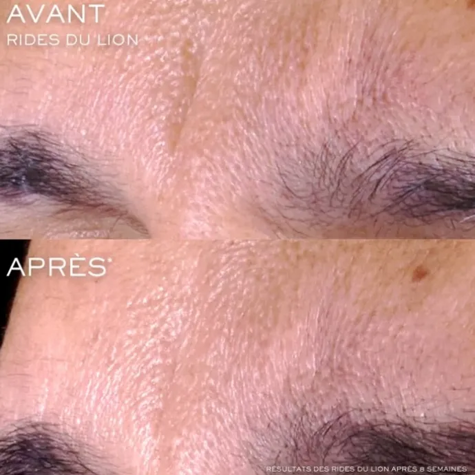 LANCÔMERénergie C.R.x. Triple Sérum Rétinol Sérum Visage