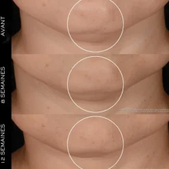 LANCÔMERénergie H.P.N. 300-Peptide                Crème Anti-Âge Haute-Performance - Recharge